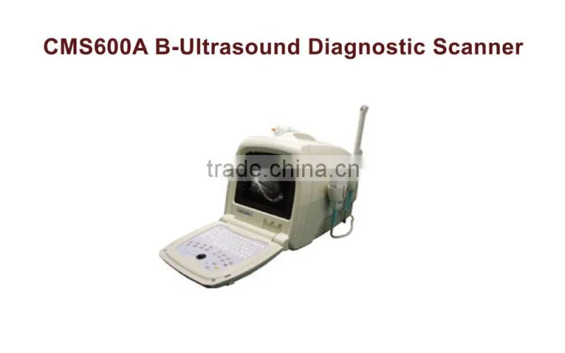 Portable B-Ultrasound Diagnostic scanner CMS600A portable ultrasound scanner