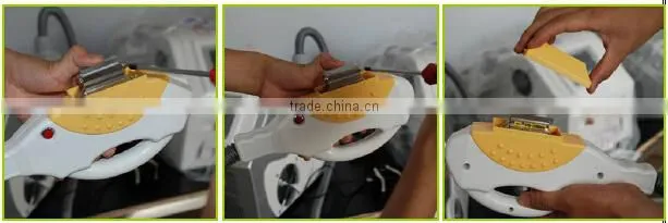 2015 Vertical vascular therapy machine intense pulsed light