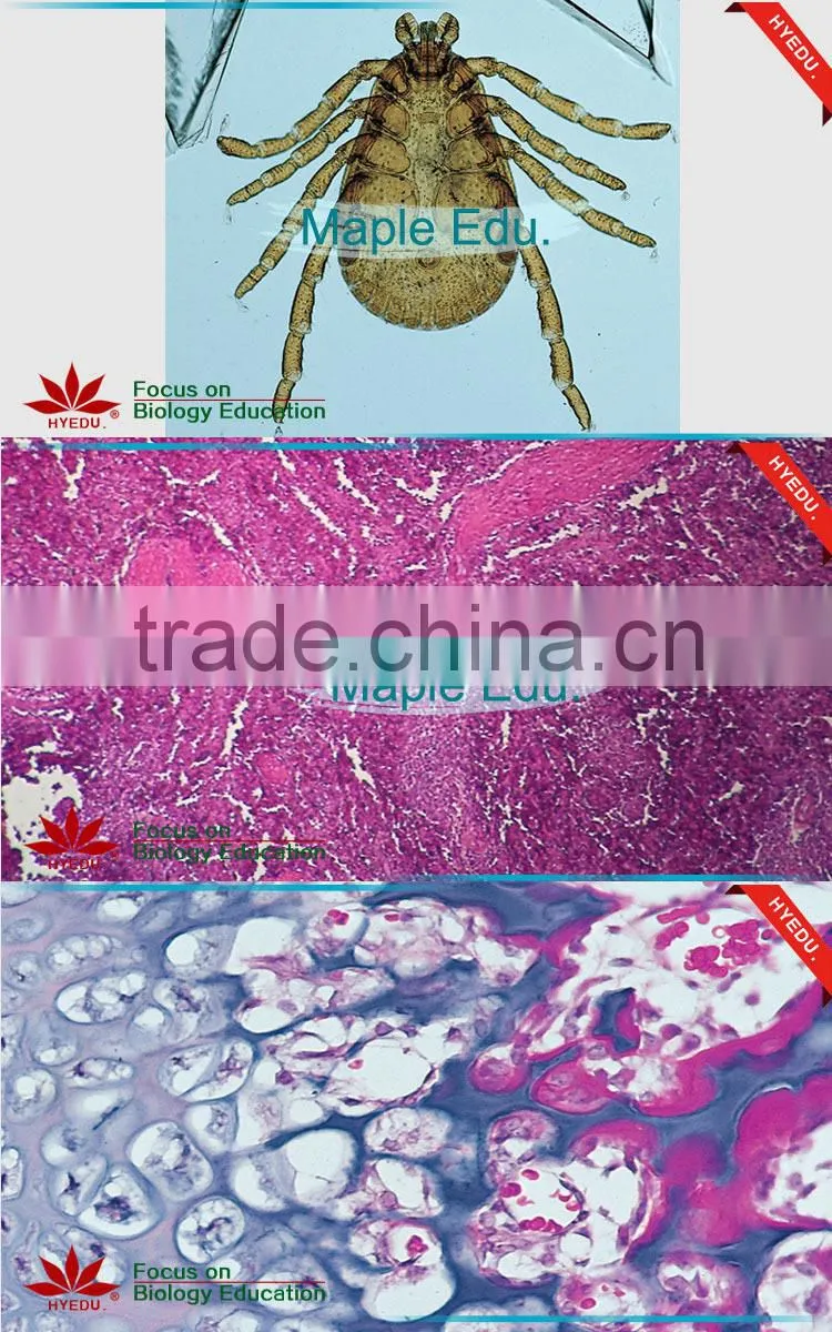 Mixed high quality beat price medical histology microscope prepared glass slides