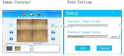 Professional 5 MP smart uv skin analyzer/ skin test machine