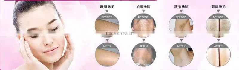 ipl hair removal laser machine prices