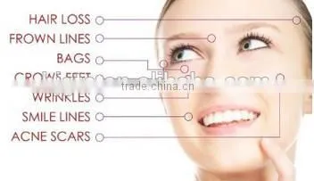 Hot Sale 180 Needles Eye Derma Roller