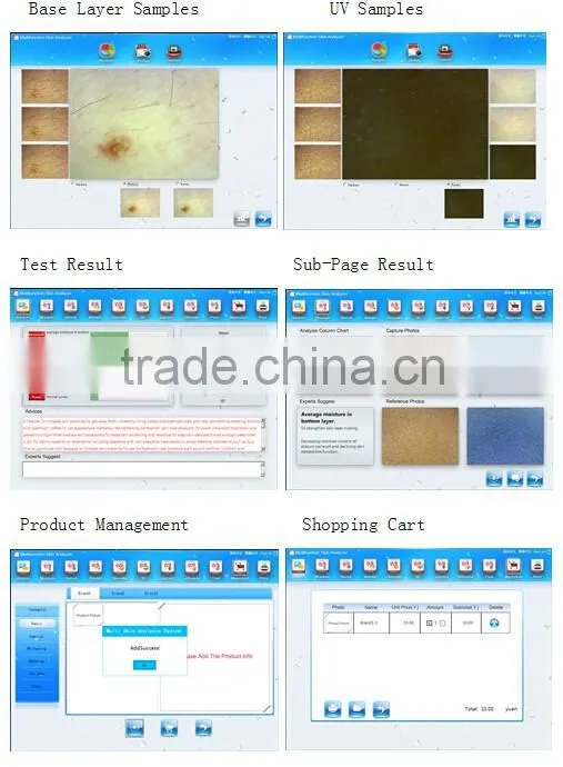 Professional 5 MP smart uv skin analyzer/ skin test machine