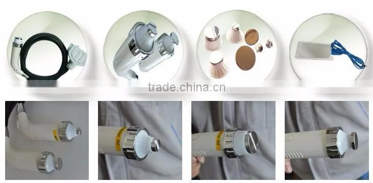 2016 new elight ipl+rf beauty equipment