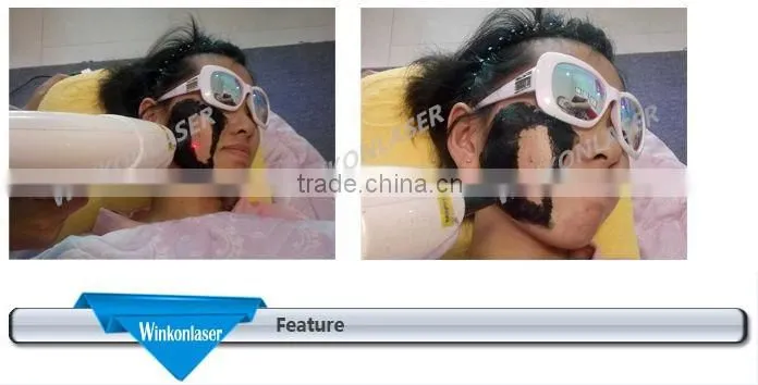 home aqua peel machine for skin treatment