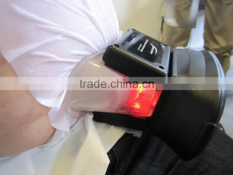 cryolipolysis body shaping machine (very hot in Europe!!!!)