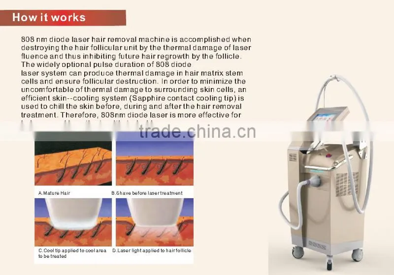 New Style Best Effective Vertical Fast Depilacion Diode Laser Beauty Maquina