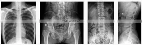 Digital Radiography system