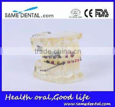 High Quality Dental Transparent Orthodontic Models School Teaching Demonstration