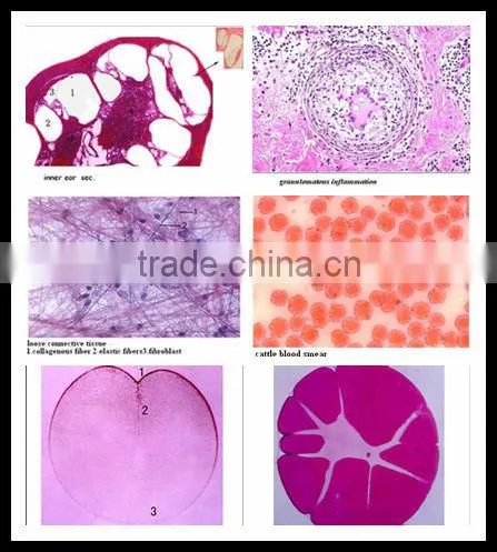 Your best choose 100pcs mixed histology slides set from factory