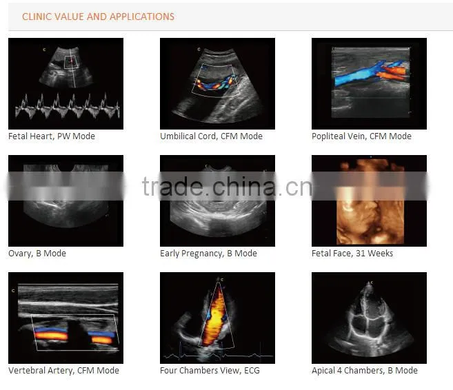 3D Trolley ultrasound scanner Color doppler ultrasound system (optional 4D)