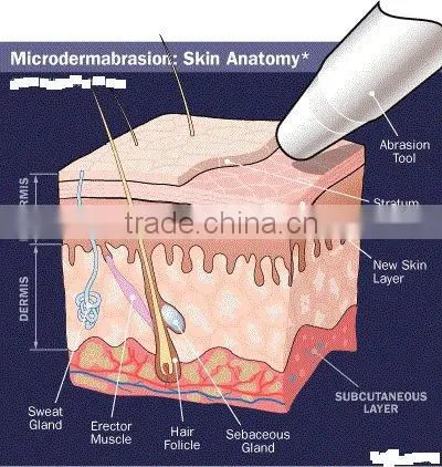 Cold hammer & Dermabrasion Skin Rejuvenation