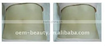 ultrasonic body sculpting cavitation machine F006