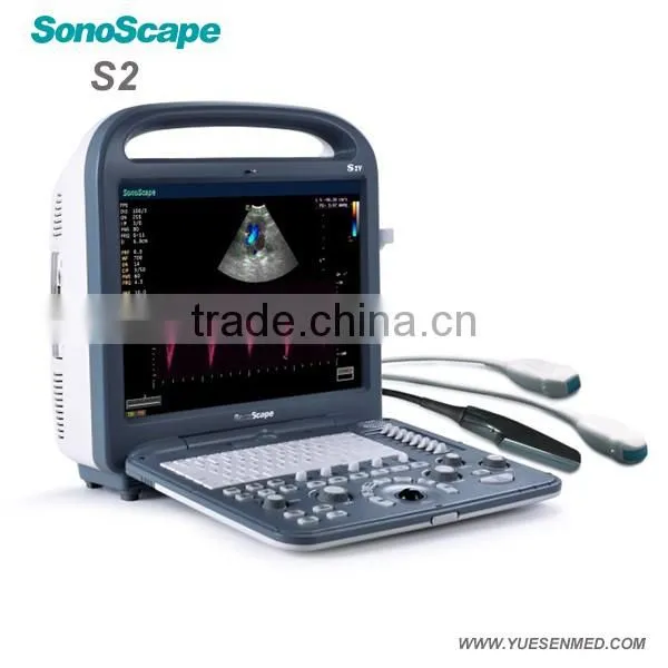 Color ultrasound scanner sonoscape veterinary ultrasound