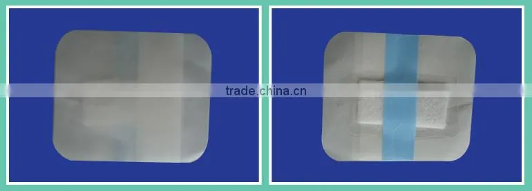 Infected Newborn Umbilical Paste Protection Care