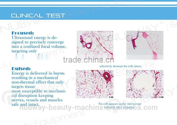 FDA Approved High Intensity Focused Ultrasound Korea HIFU For Loss Weight