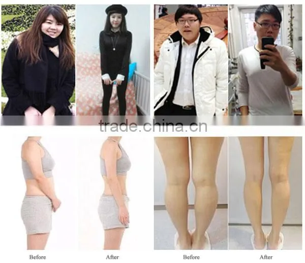 distributor wanted Oyaga N8+2 vacuum rf obesity therapy machine