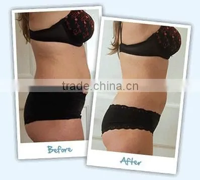 lipolaser machine for body shaping