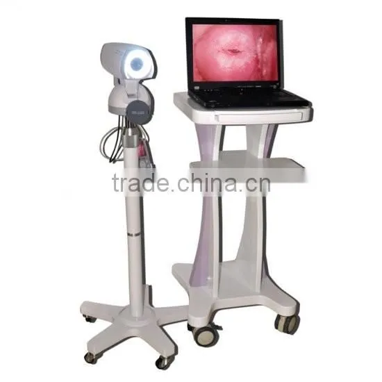 FY-9100A Excellent Portable Type Digital Electronic Colposcope