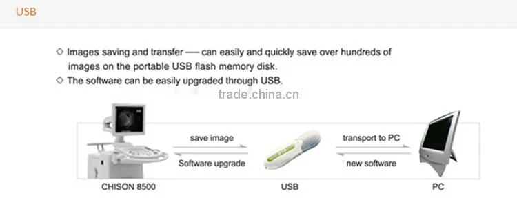 MCB-8500 High definition Black and White Ultrasound Machine best price for portable echographe doppler mindray