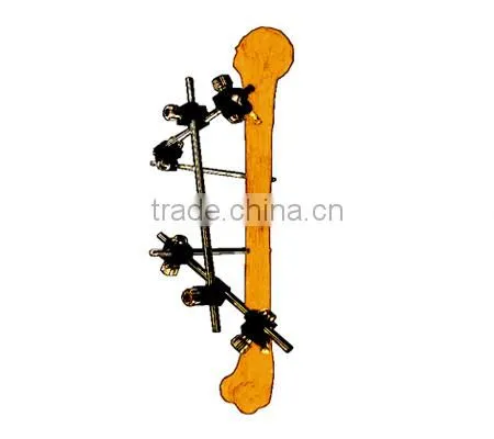 Rod and Screw Fixator(locating fractures quickly)