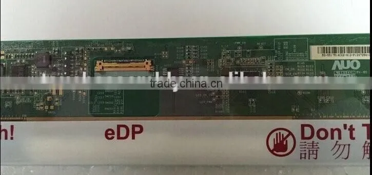 high quality 17.3 LCD screen B173RTN01.1 DP/N 03V6TR EDP