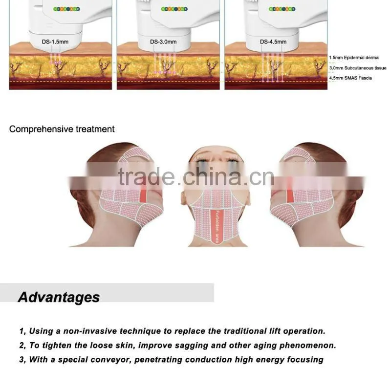 most popular best effect ultrasound 4mhz ultrasound facial machine