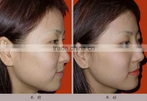 Clinic use skin whitening solution red led light machine