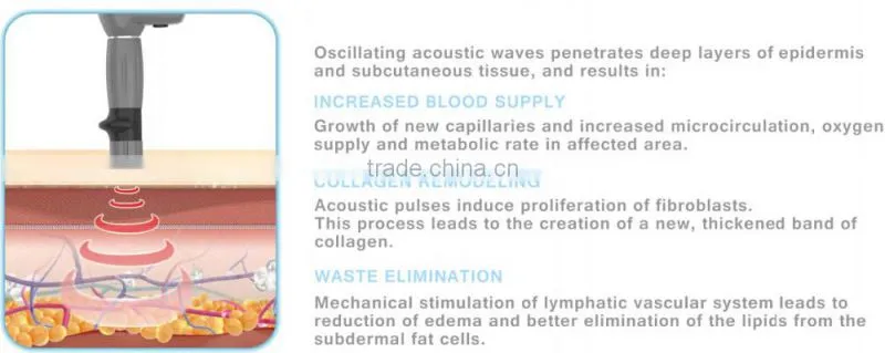 ESWT Shock Wave Therapy For Cellulite Treatment Devices - ESWT SD
