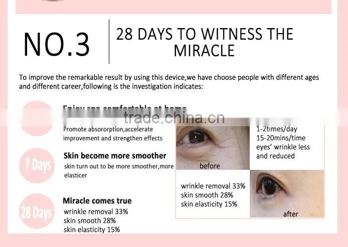 Negative ion eye wrinkle removal massager with good use
