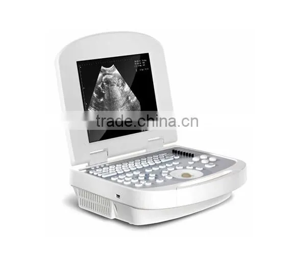 2017 newest B/W Ultrasound Imaging System 3.5Mhz convex probe laptop ultrasound scanner
