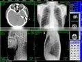 Medical film digitizer for PACS