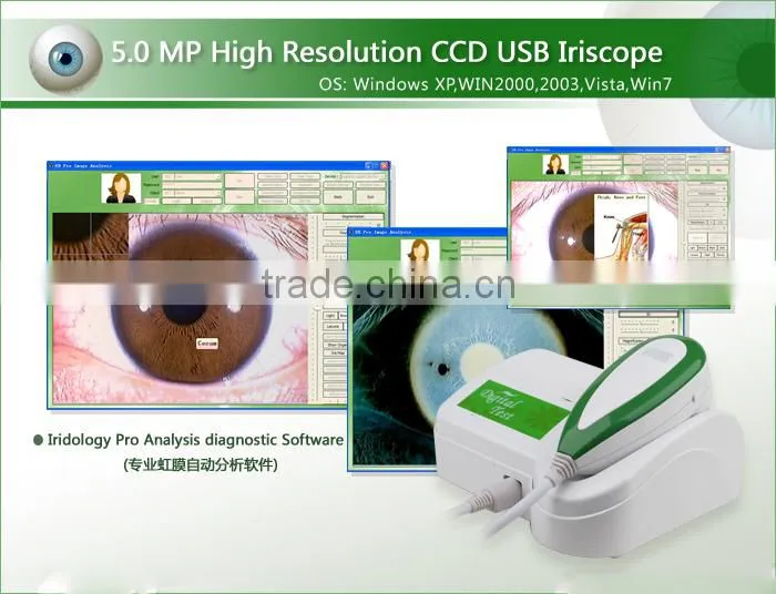 AYJ-J014 boxy skin and hair analyzer/skin analyzer beauty machine with CE