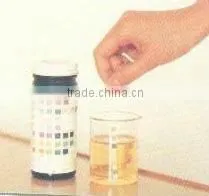 Urine Control Urine Analysis System YH-1520A