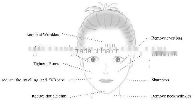 AYJ-M08 home use microneedle fractional rf, double chin removal machine