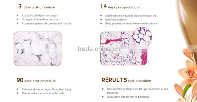 Salon use Cryo Fat Freeze Cryo Slimming Machine for sale BD05B