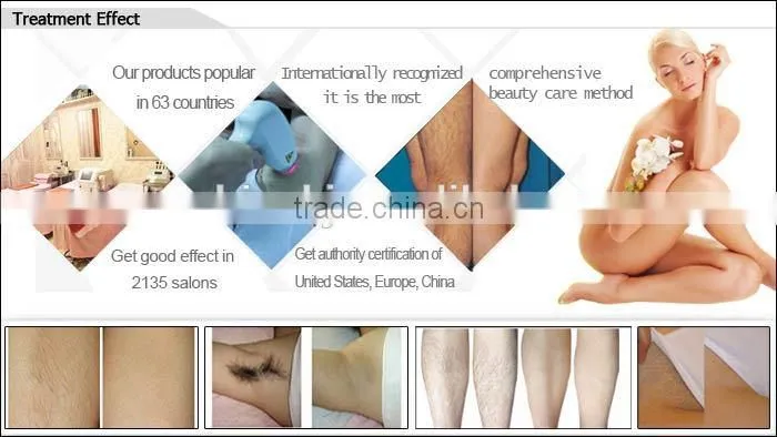 Hot selling two TEC condenser portable permanent hair removal 808nm diode laser threading hair removal electric