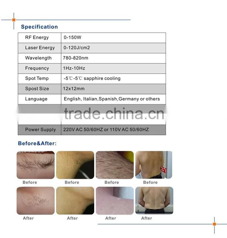 Portable 808nm and RF combined diode laser machine