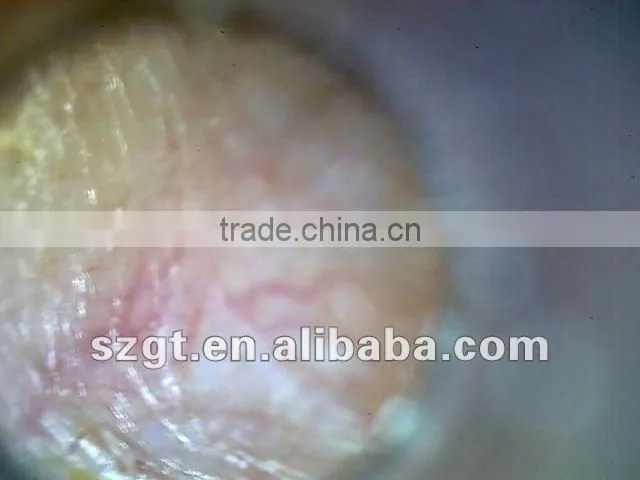 USB ear camera
