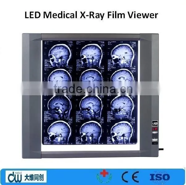 medical LED adjustable film viewer / x ray machine/ negatoscope