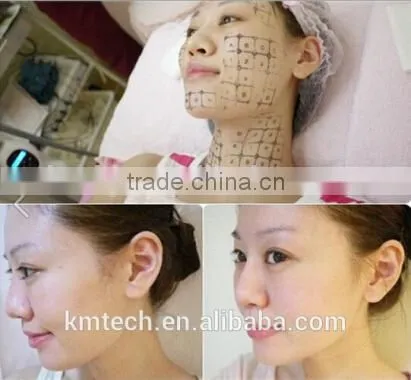 Face Lifting Portable Fractional RF High Quality fractional rf micro needle For Salon Use