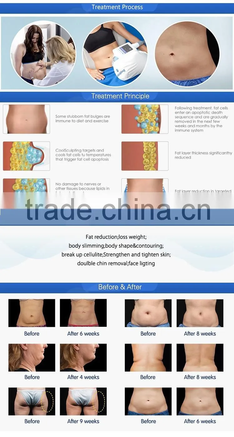 Low price Cold Freeze Fat Body Slim Slimming laser Weight Loss Machine for home