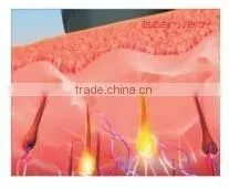 Painless vertical elight Hair Removal Equipment and skin rejuvenation machine