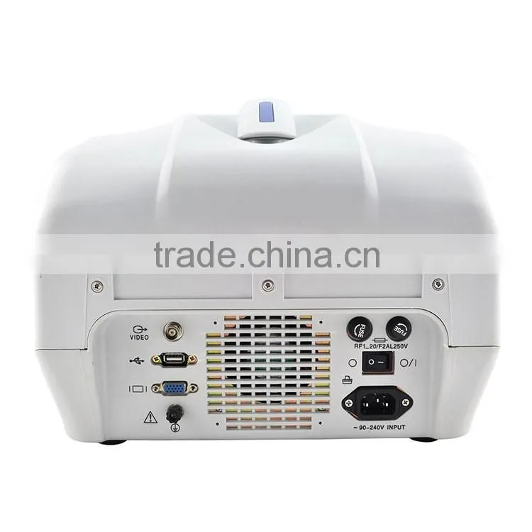 CE approved 3.5Mhz multi-frequency convex probe Portable veterinary ultrasound scanner