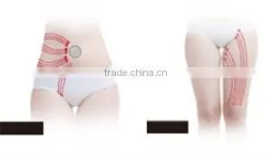 Best rf skin tightening face lifting machine