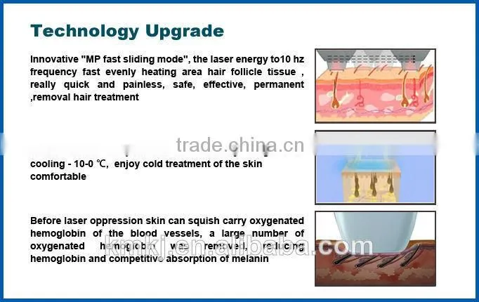 Top sale! portable 808nm diode laser hair removal machine