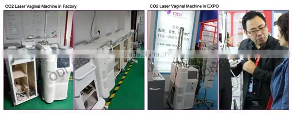 Alibaba express vaginal tightening co2 fraction laser OD-V8