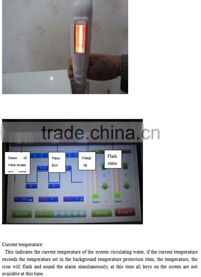 E-LIGHT Treatment High Quality Laser Tattoo Removal Machine