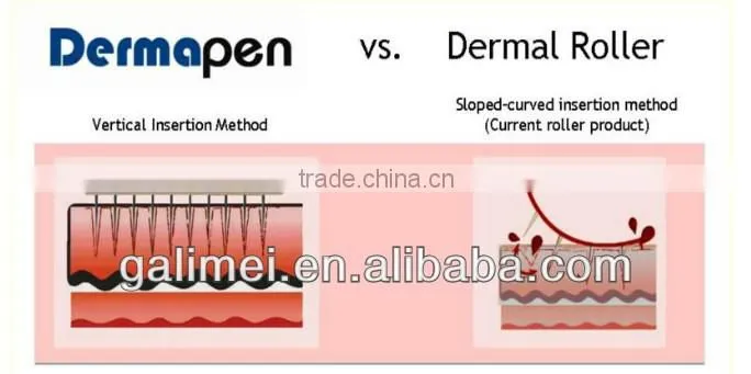 New design home use micro-needling derma pen