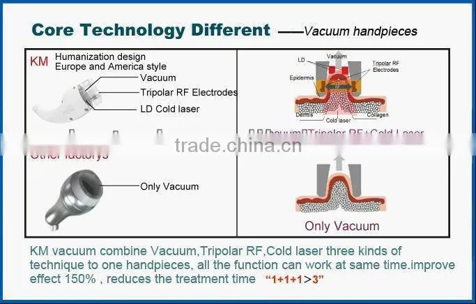 Instant Result vacuum cavitation weight loss equipment